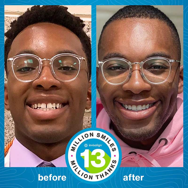 Before and After Photo of a man using Invisalign®
